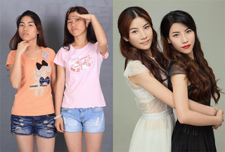 Illustration for article titled Intense Photos of Plastic Surgery Tranformations Going Viral in China